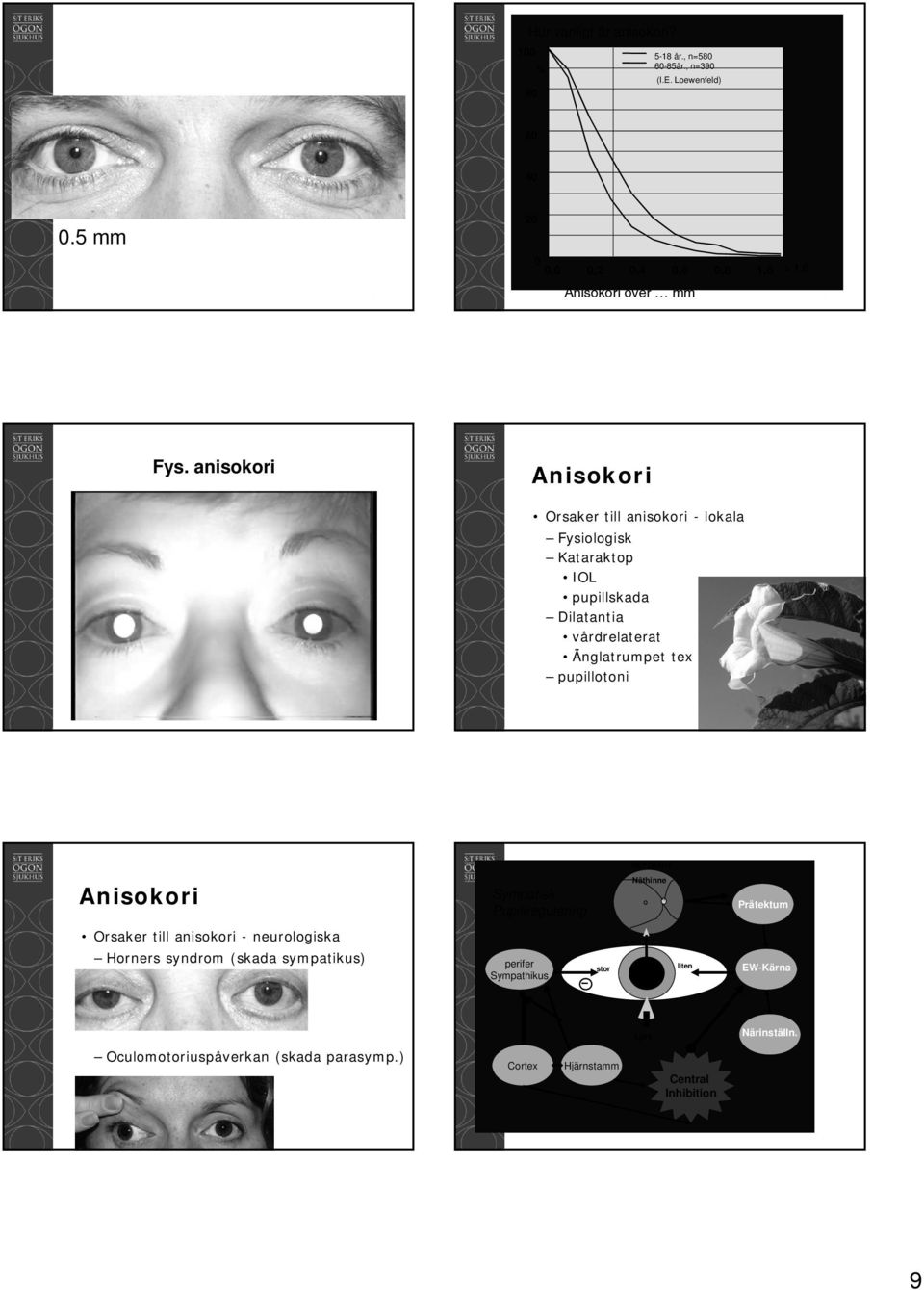 anisokori Anisokori Orsaker till anisokori - lokala Fysiologisk Kataraktop IOL pupillskada Dilatantia vårdrelaterat Änglatrumpet tex pupillotoni