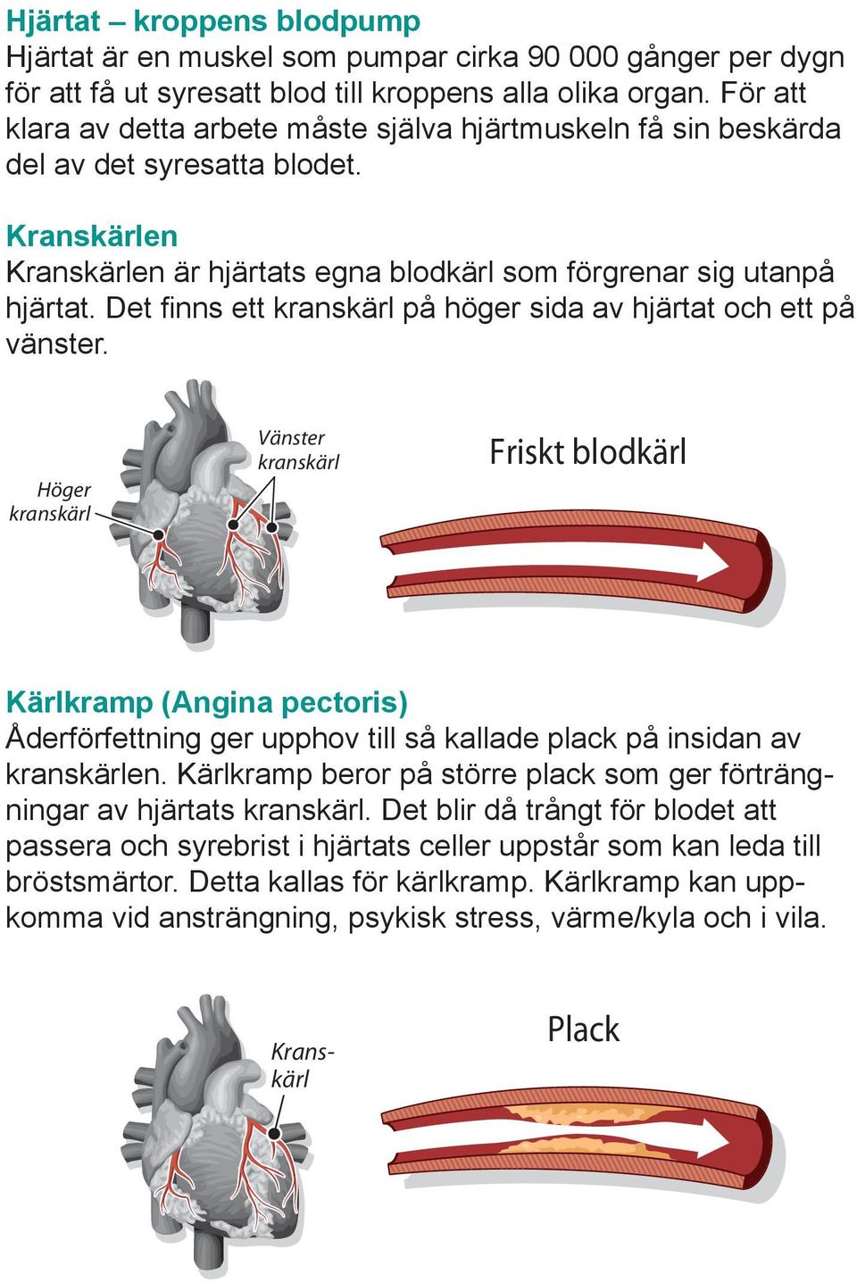 Det finns ett kranskärl på höger sida av hjärtat och ett på vänster.