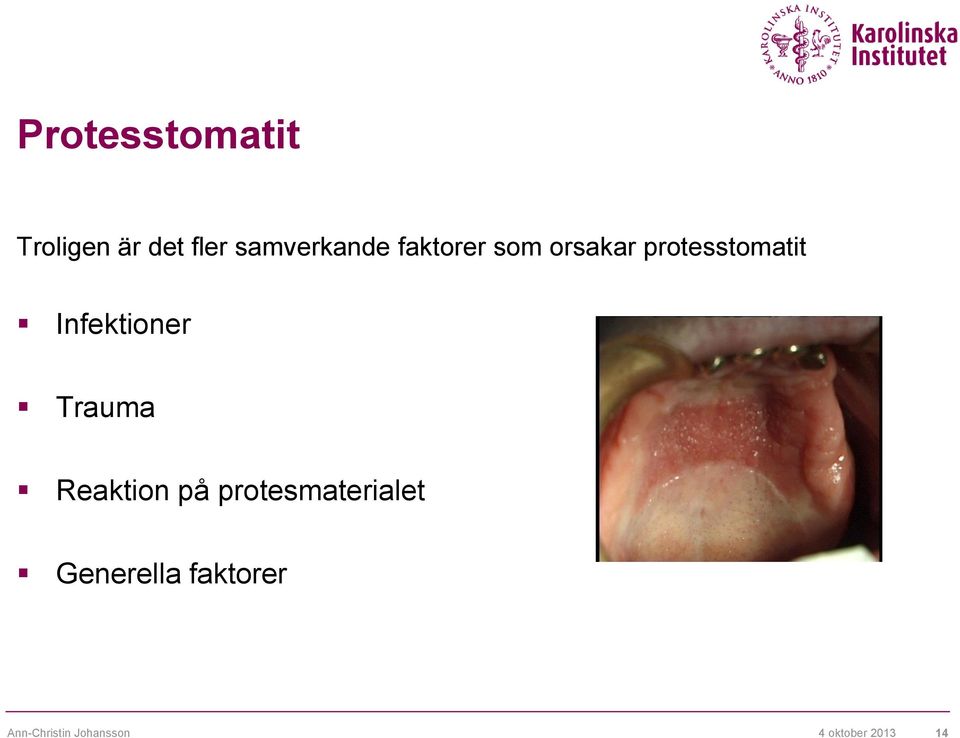 Trauma Reaktion på protesmaterialet Generella