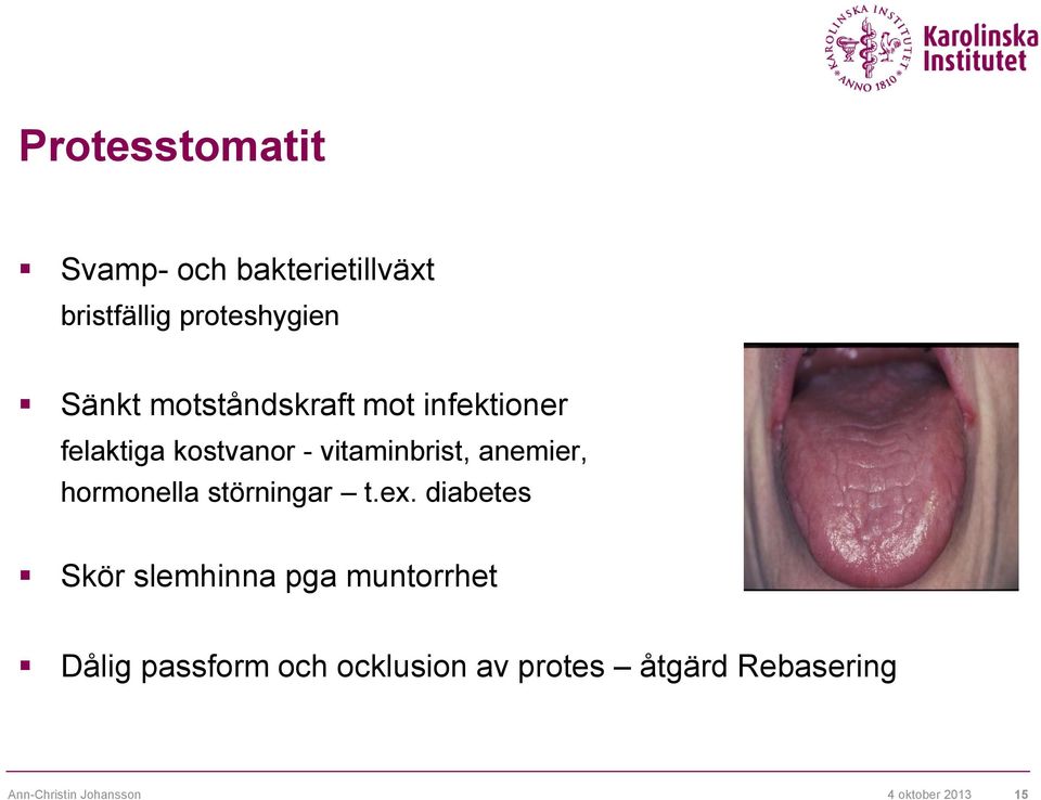 hormonella störningar t.ex.