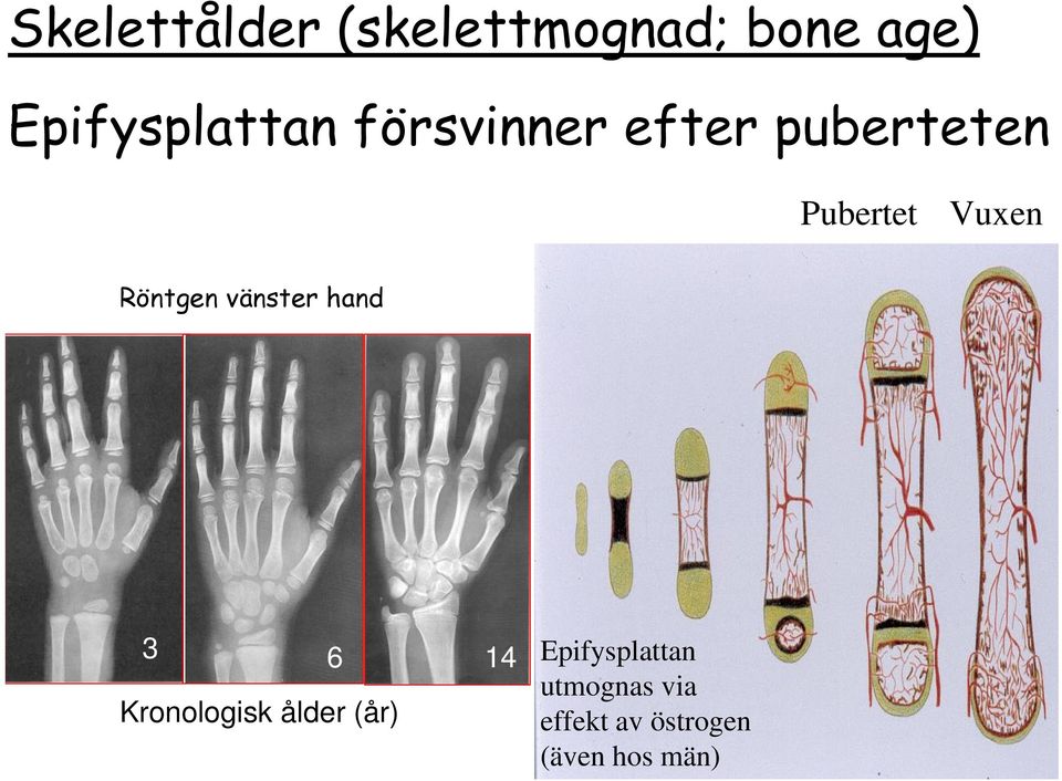 Vuxen Röntgen vänster hand 3 6 14 Kronologisk ålder