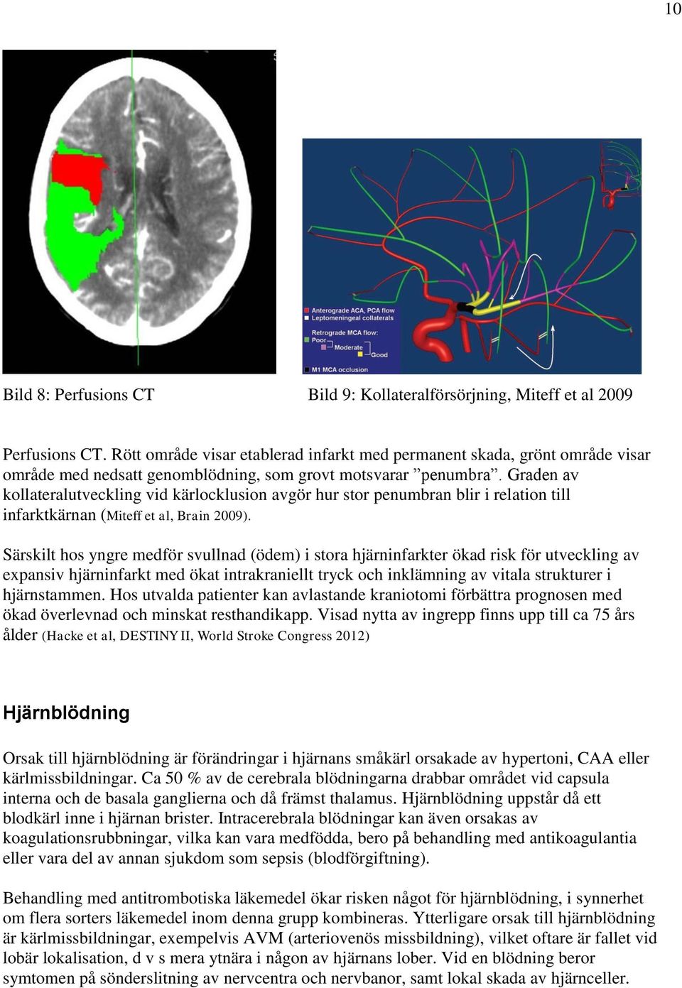 Graden av kollateralutveckling vid kärlocklusion avgör hur stor penumbran blir i relation till infarktkärnan (Miteff et al, Brain 2009).