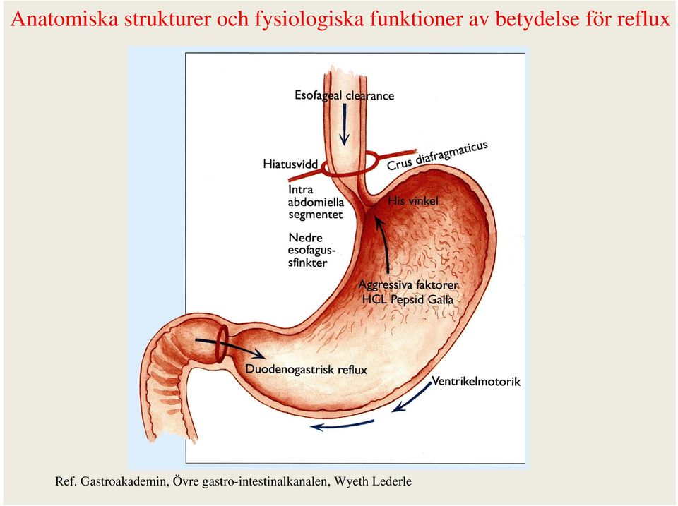 betydelse för reflux Ref.