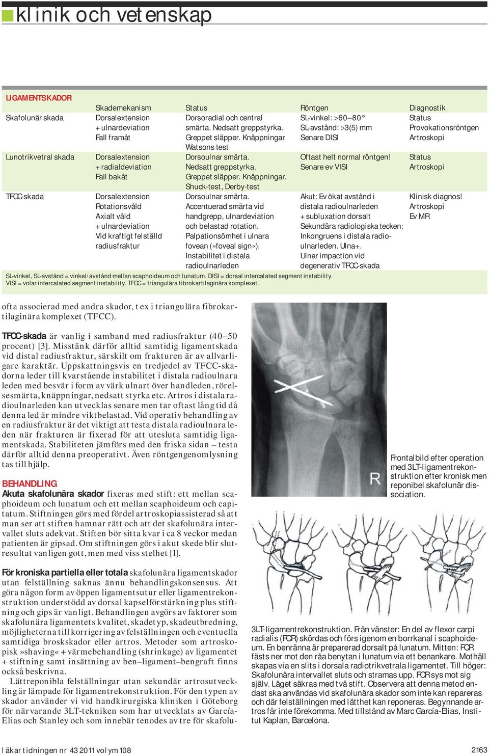 Behandlingen avgörs av faktorer som skafolunära ligamentets kvalitet, skadetyp, skadeutbredning, möjligheterna till korrigering av felställningen och eventuella samtidiga broskskador eller artros.
