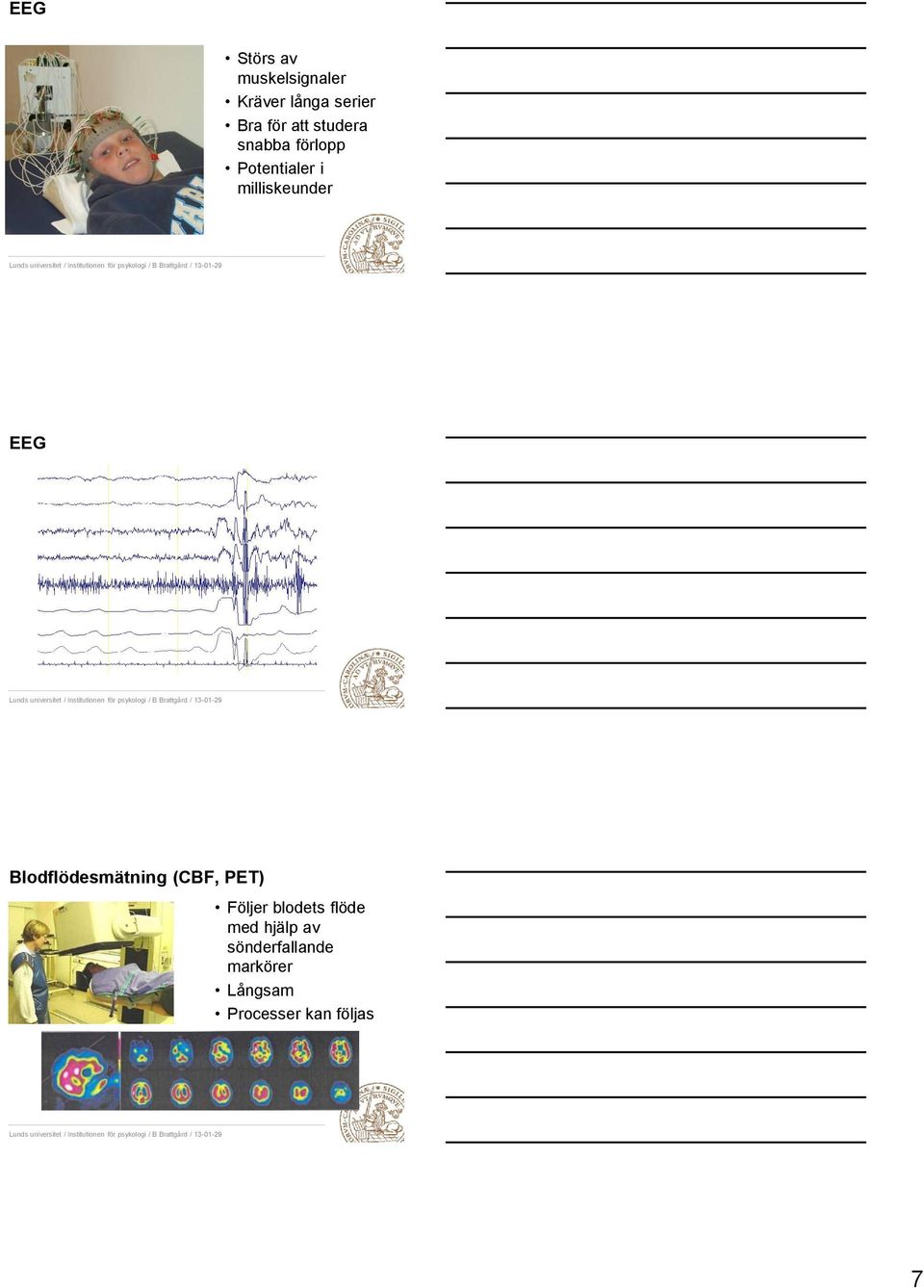 EEG Blodflödesmätning (CBF, PET) Följer blodets flöde med