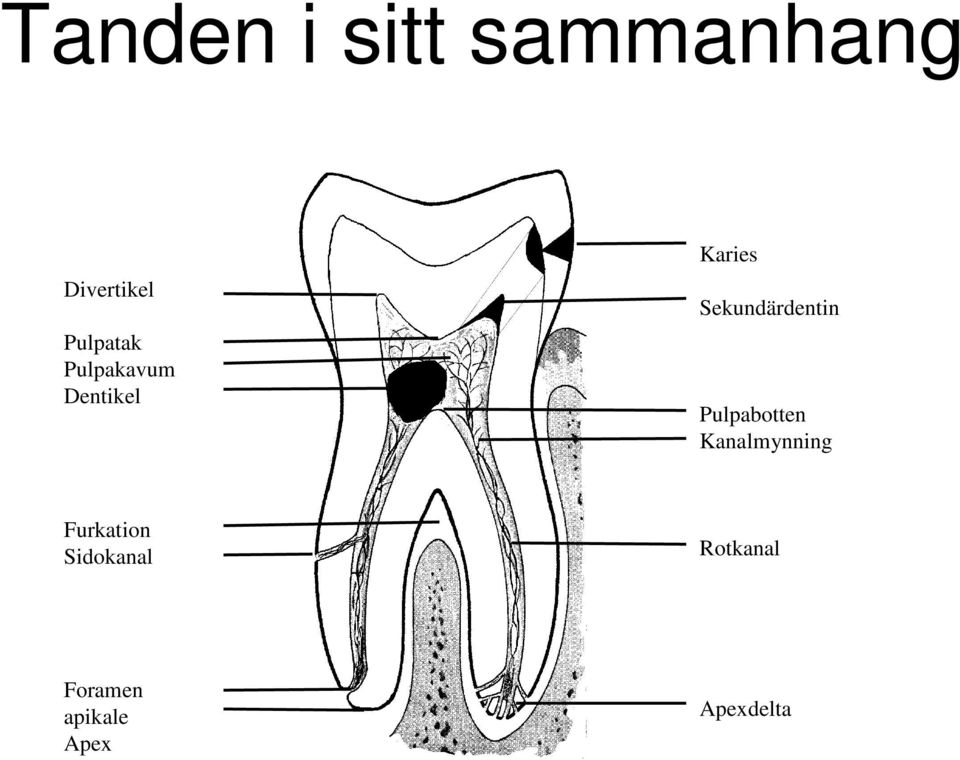 Sekundärdentin Pulpabotten Kanalmynning