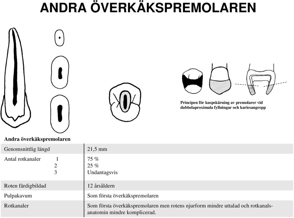 Pulpakavum Rotkanaler 21,5 mm 75 % 25 % Undantagsvis 12 årsåldern Som första överkäkspremolaren Som