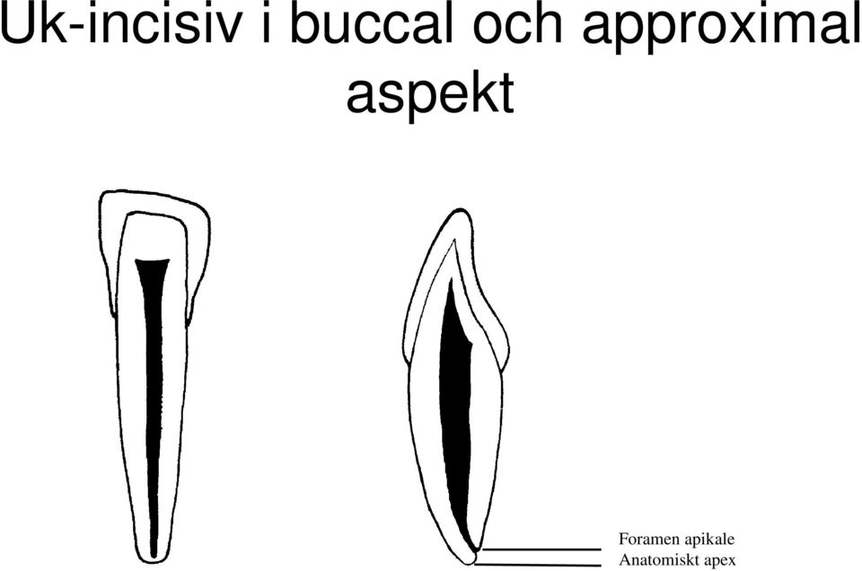 approximal aspekt