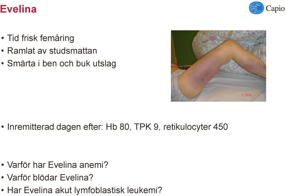 TPK 9, retikulocyter 450 Varför har Evelina anemi?