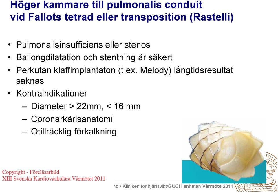 är säkert Perkutan klaffimplantaton (t ex.