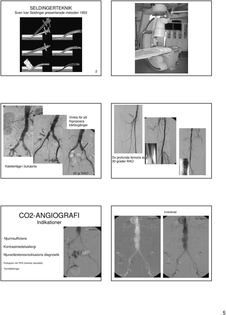 grader RAO 30 gr RAO CO2-ANGIOGRAFI Indikationer inverterad Njurinsufficiens