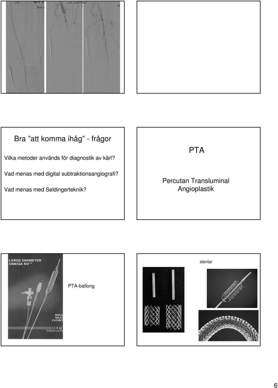 PTA Vad menas med digital subtraktionsangiografi?