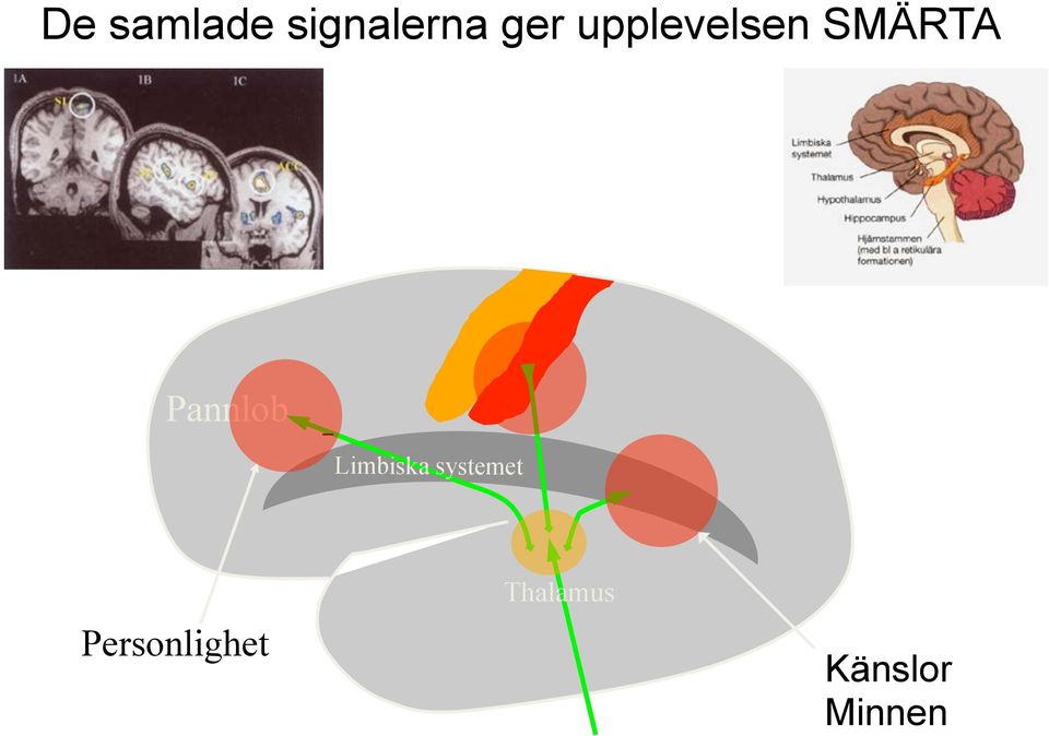 Limbiska systemet