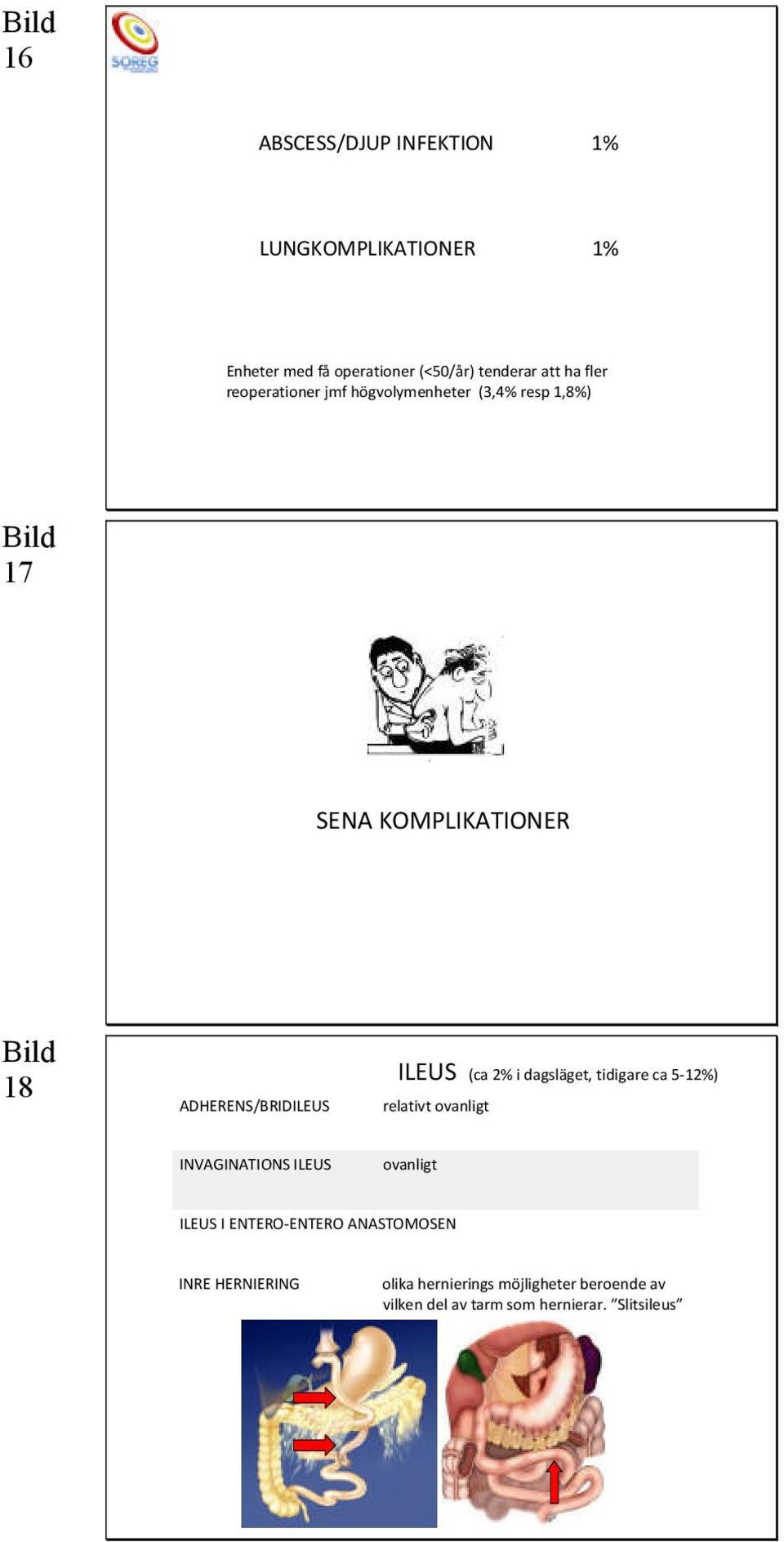 2% i dagsläget, tidigare ca 5-12%) relativt ovanligt INVAGINATIONS ILEUS ovanligt ILEUS I ENTERO-ENTERO