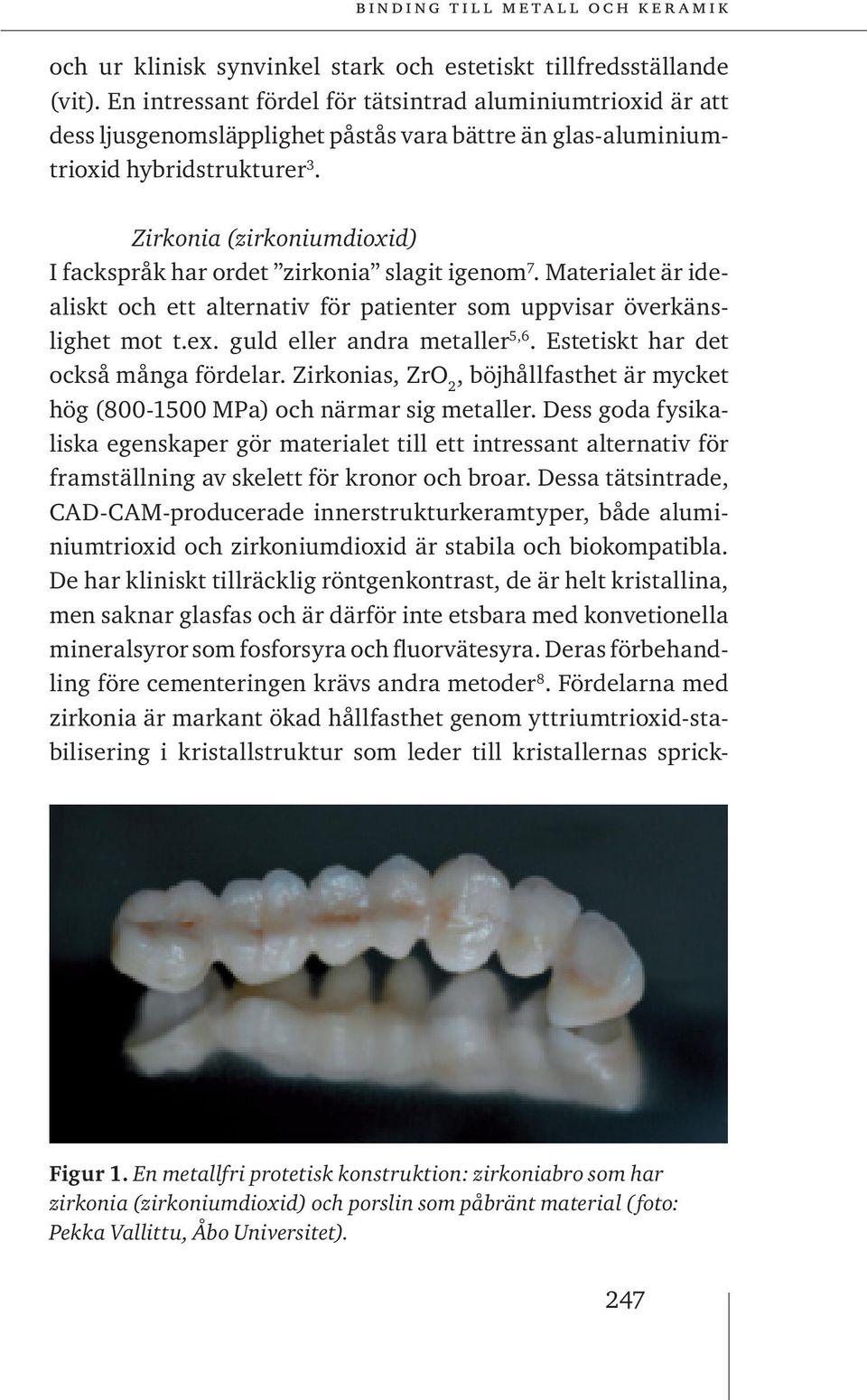 Zirkonia (zirkoniumdioxid) I fackspråk har ordet zirkonia slagit igenom 7. Materialet är idealiskt och ett alternativ för patienter som uppvisar överkänslighet mot t.ex. guld eller andra metaller 5,6.