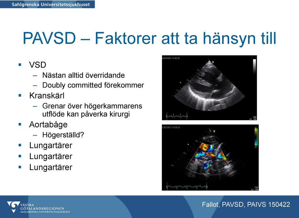 Grenar över högerkammarens utflöde kan påverka