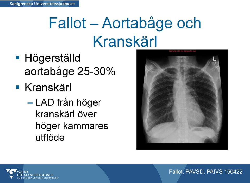 Kranskärl LAD från höger