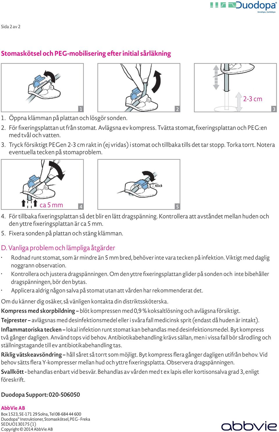 Notera eventuella tecken på stomaproblem. 3 ca 5 mm Duodopa Instruktioner, Stomaskötsel, PEG - Freka SEDUO130175 (1) Copyright 2014 4 4. För tillbaka fixeringsplattan så det blir en lätt dragspänning.