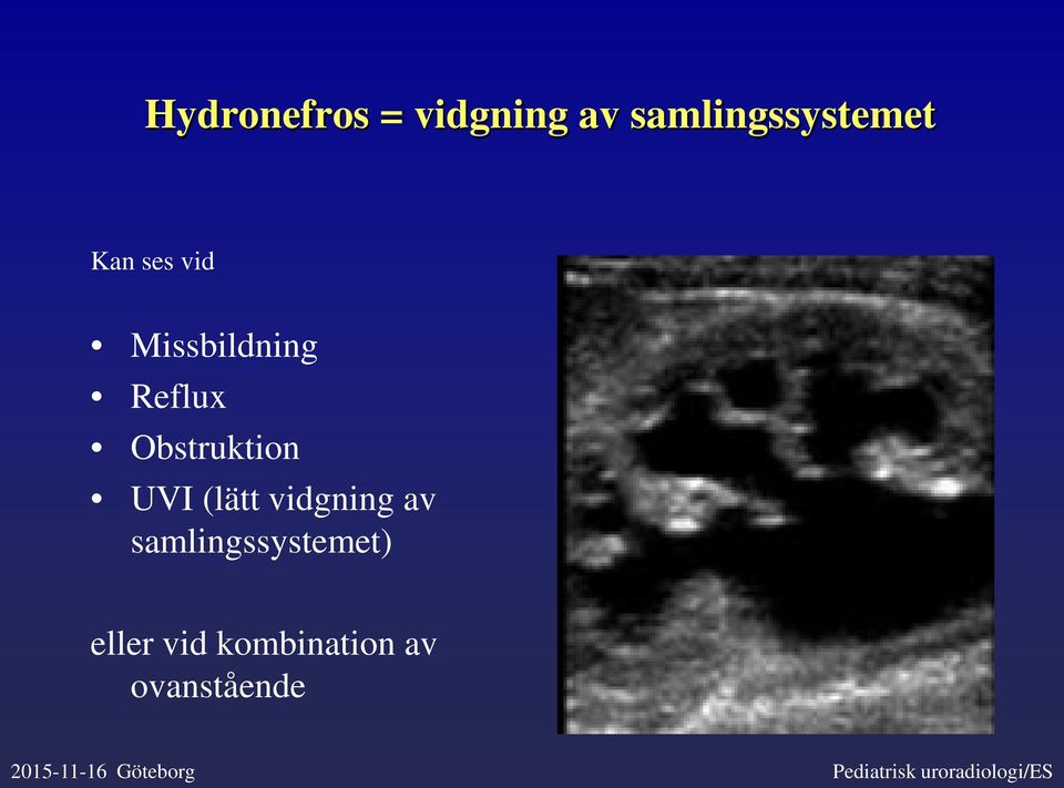 vidgning av samlingssystemet) eller vid kombination