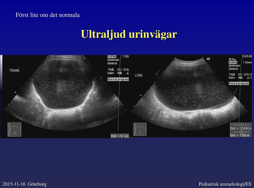 urinvägar 2015-11-16