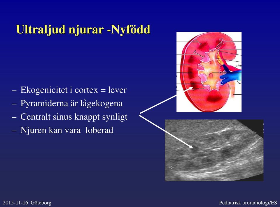 Centralt sinus knappt synligt Njuren kan vara