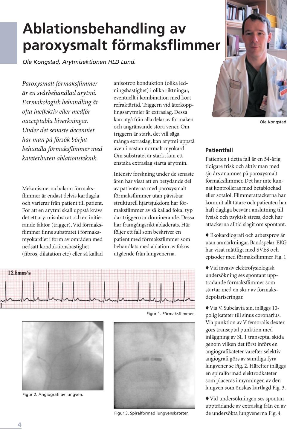 Mekanismerna bakom förmaksflimmer är endast delvis kartlagda och varierar från patient till patient. För att en arytmi skall uppstå krävs det ett arytmisubstrat och en initierande faktor (trigger).