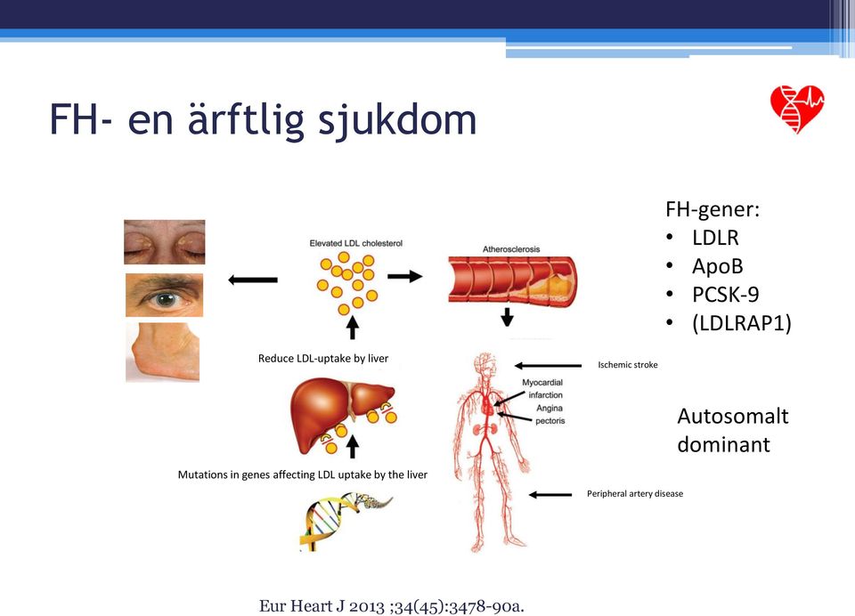 Autosomalt dominant Mutations in genes affecting LDL