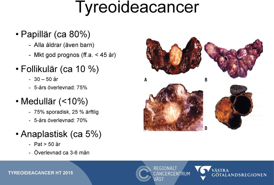 < 45 år) Follikulär (ca 10 %) - 30 50 år - 5-års överlevnad: 75%