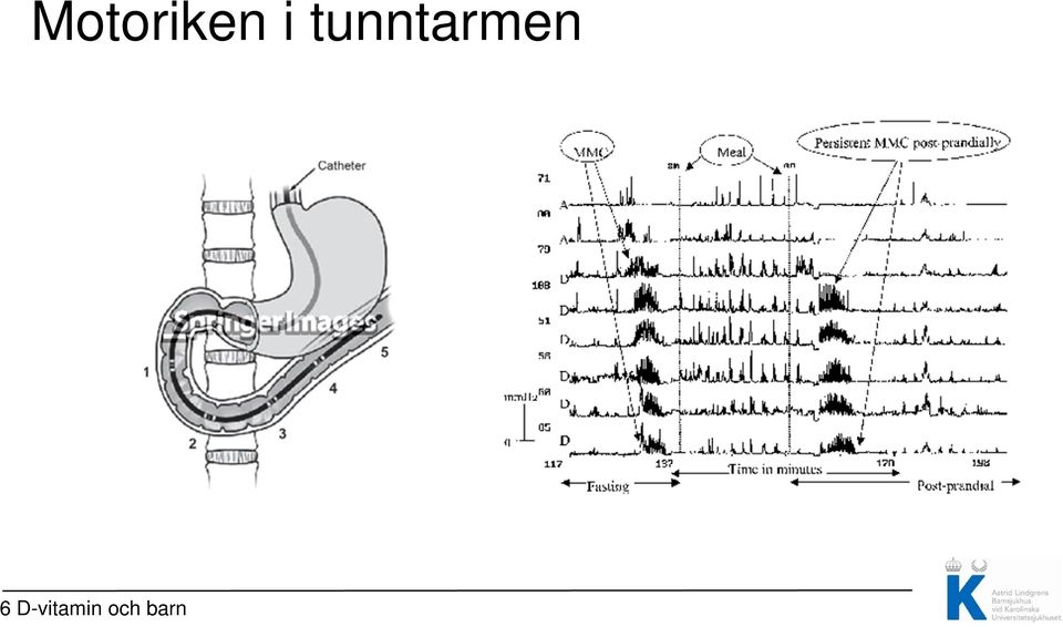 tunntarmen