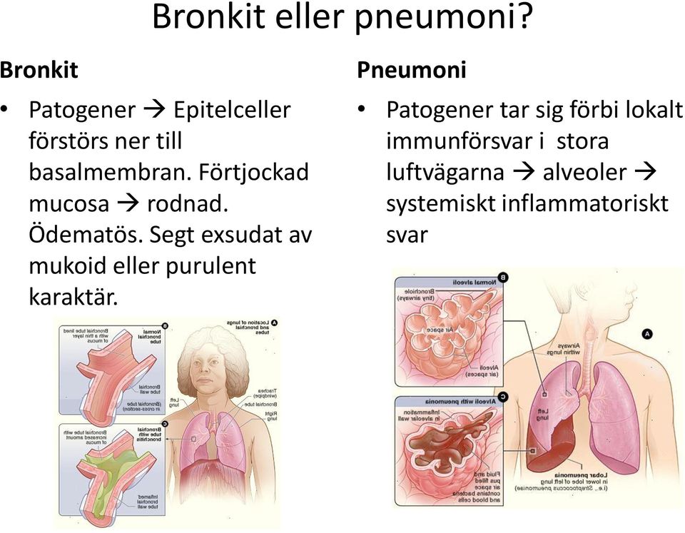 Förtjockad mucosa rodnad. Ödematös.