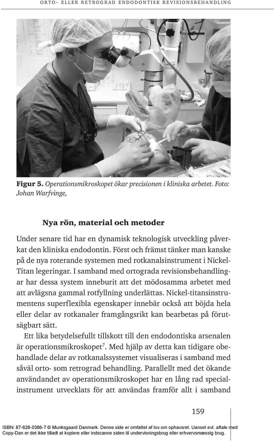 Först och främst tänker man kanske på de nya roterande systemen med rotkanalsinstrument i Nickel- Titan legeringar.