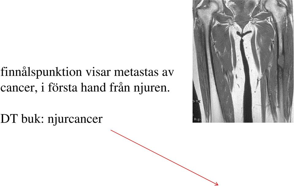 första hand från