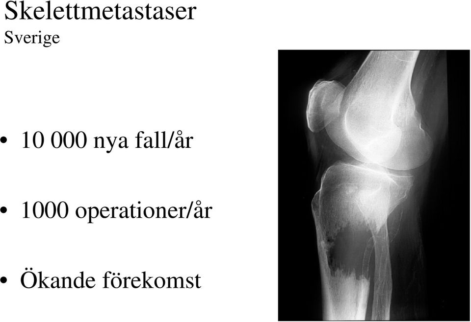 fall/år 1000