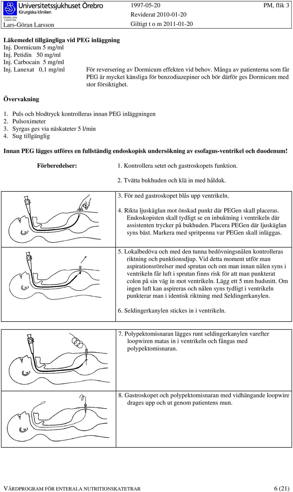 Många av patienterna som får PEG är mycket känsliga för benzodiazepiner och bör därför ges Dormicum med stor försiktighet.