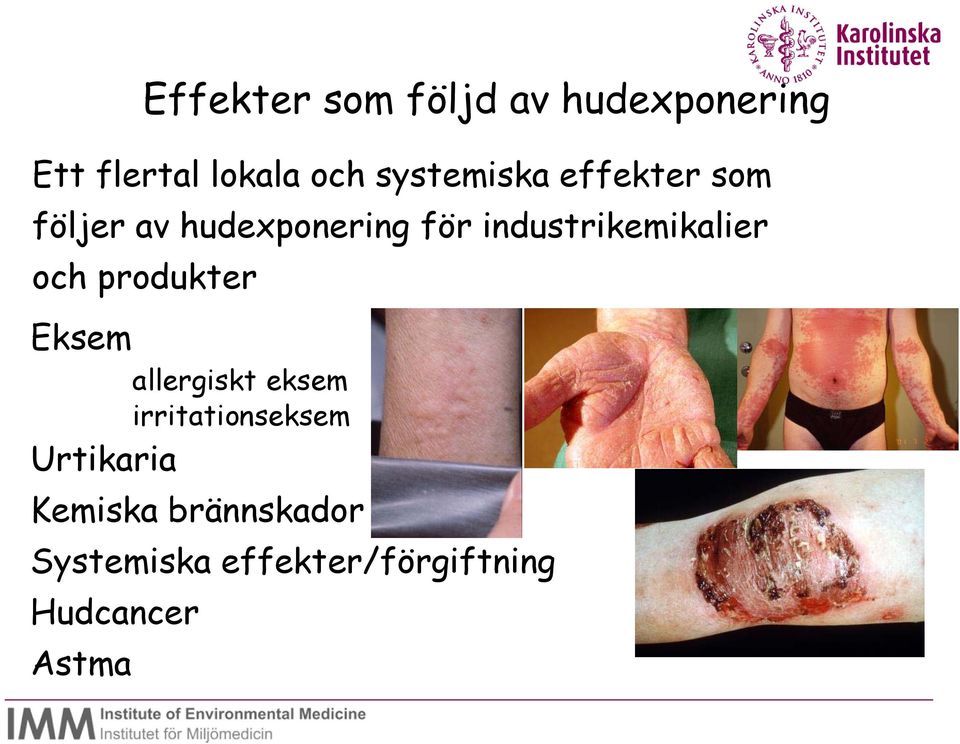 industrikemikalier och produkter Eksem allergiskt eksem