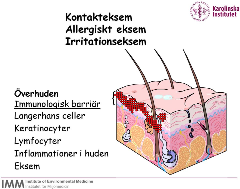 Immunologisk barriär Langerhans