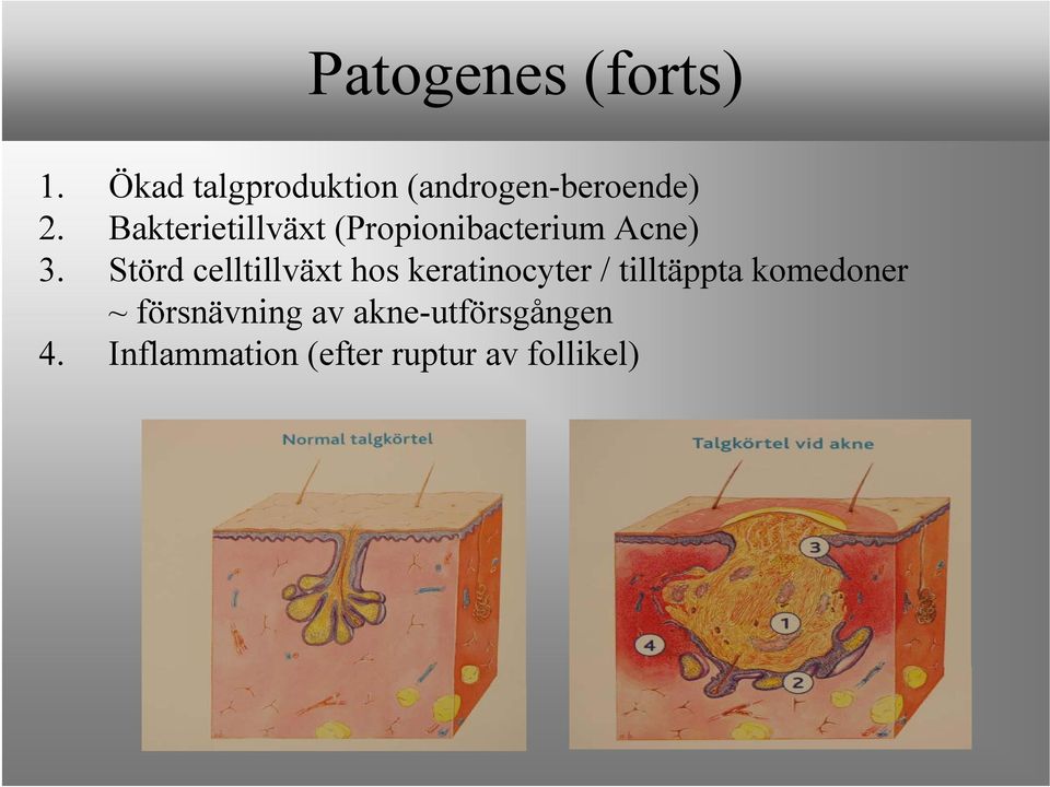 Störd celltillväxt hos keratinocyter / tilltäppta