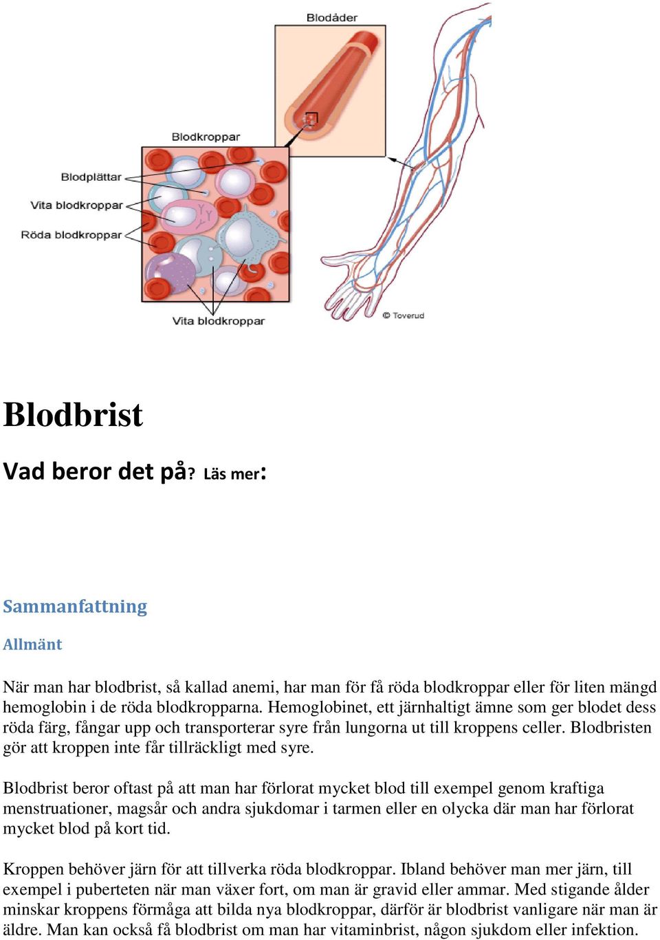 Blodbrist beror oftast på att man har förlorat mycket blod till exempel genom kraftiga menstruationer, magsår och andra sjukdomar i tarmen eller en olycka där man har förlorat mycket blod på kort tid.