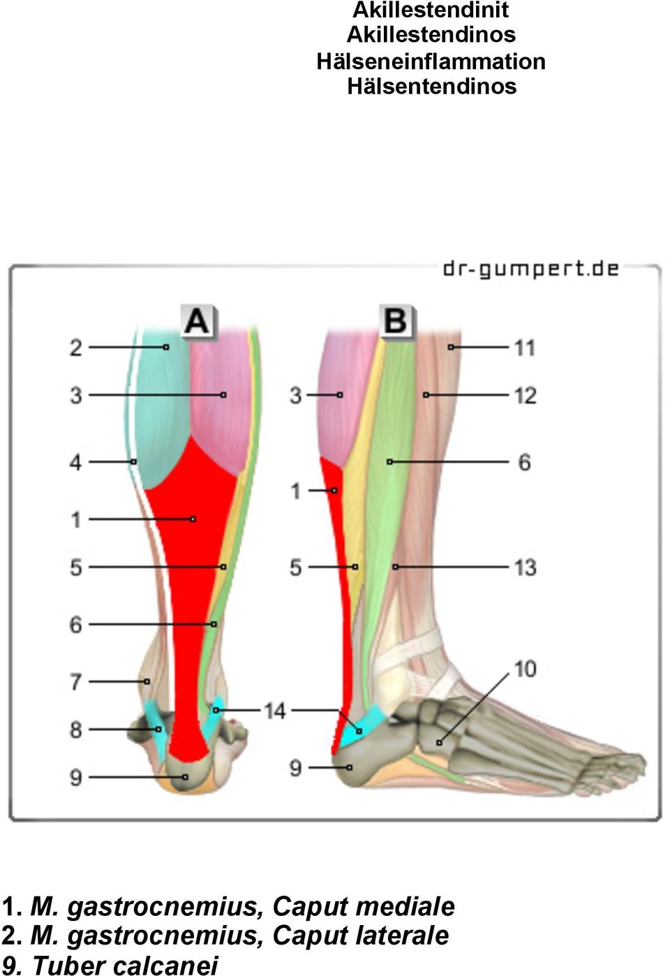 M. gastrocnemius, Caput mediale 2. M.