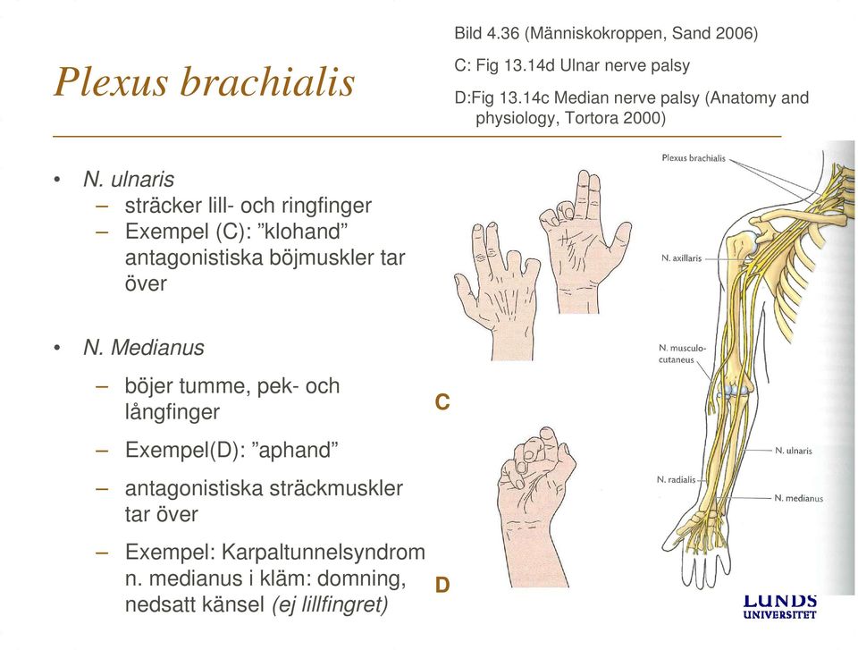 ulnaris sträcker lill- och ringfinger Exempel (C): klohand antagonistiska böjmuskler tar över N.