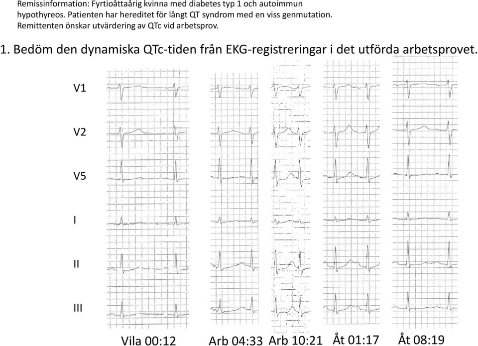 Remittenten önskar utvärdering av QTc vid arbetsprov. 1.