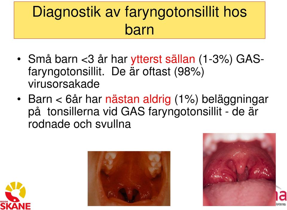 De är oftast (98%) virusorsakade Barn < 6år har nästan aldrig