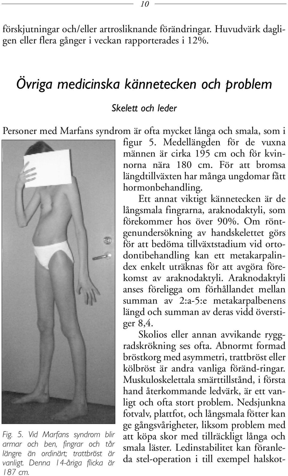 Medellängden för de vuxna männen är cirka 195 cm och för kvinnorna nära 180 cm. För att bromsa längdtillväxten har många ungdomar fått hormonbehandling.