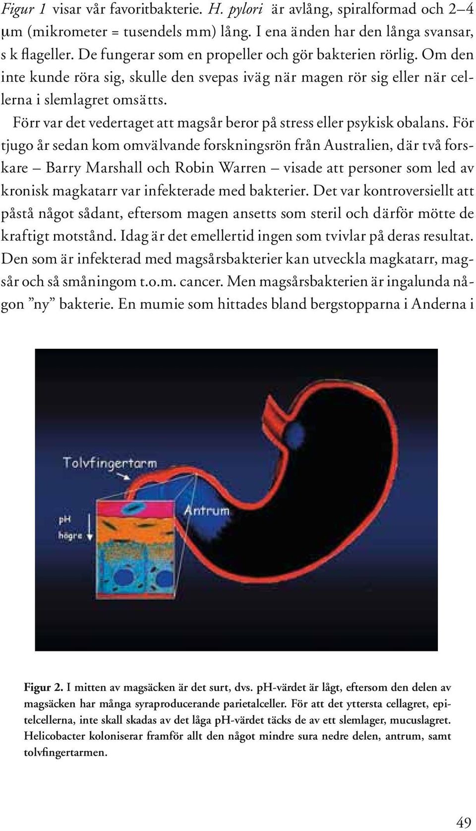 Förr var det vedertaget att magsår beror på stress eller psykisk obalans.
