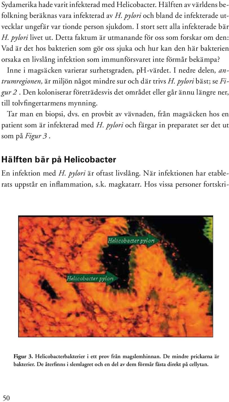 Detta faktum är utmanande för oss som forskar om den: Vad är det hos bakterien som gör oss sjuka och hur kan den här bakterien orsaka en livslång infektion som immunförsvaret inte förmår bekämpa?