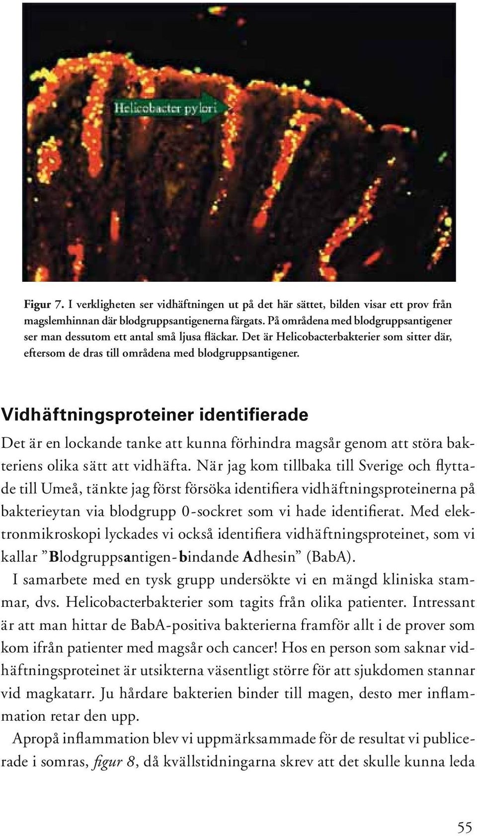 Vidhäftningsproteiner identifierade Det är en lockande tanke att kunna förhindra magsår genom att störa bakteriens olika sätt att vidhäfta.