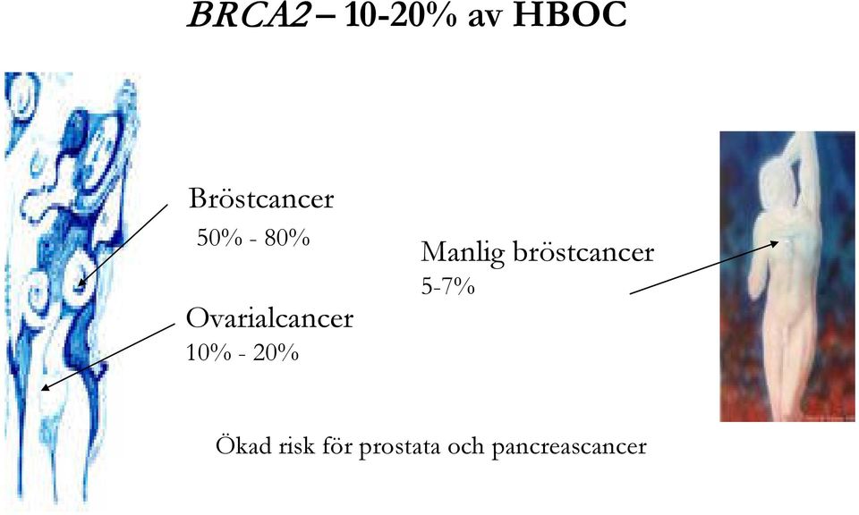 20% Manlig bröstcancer 5-7% Ökad