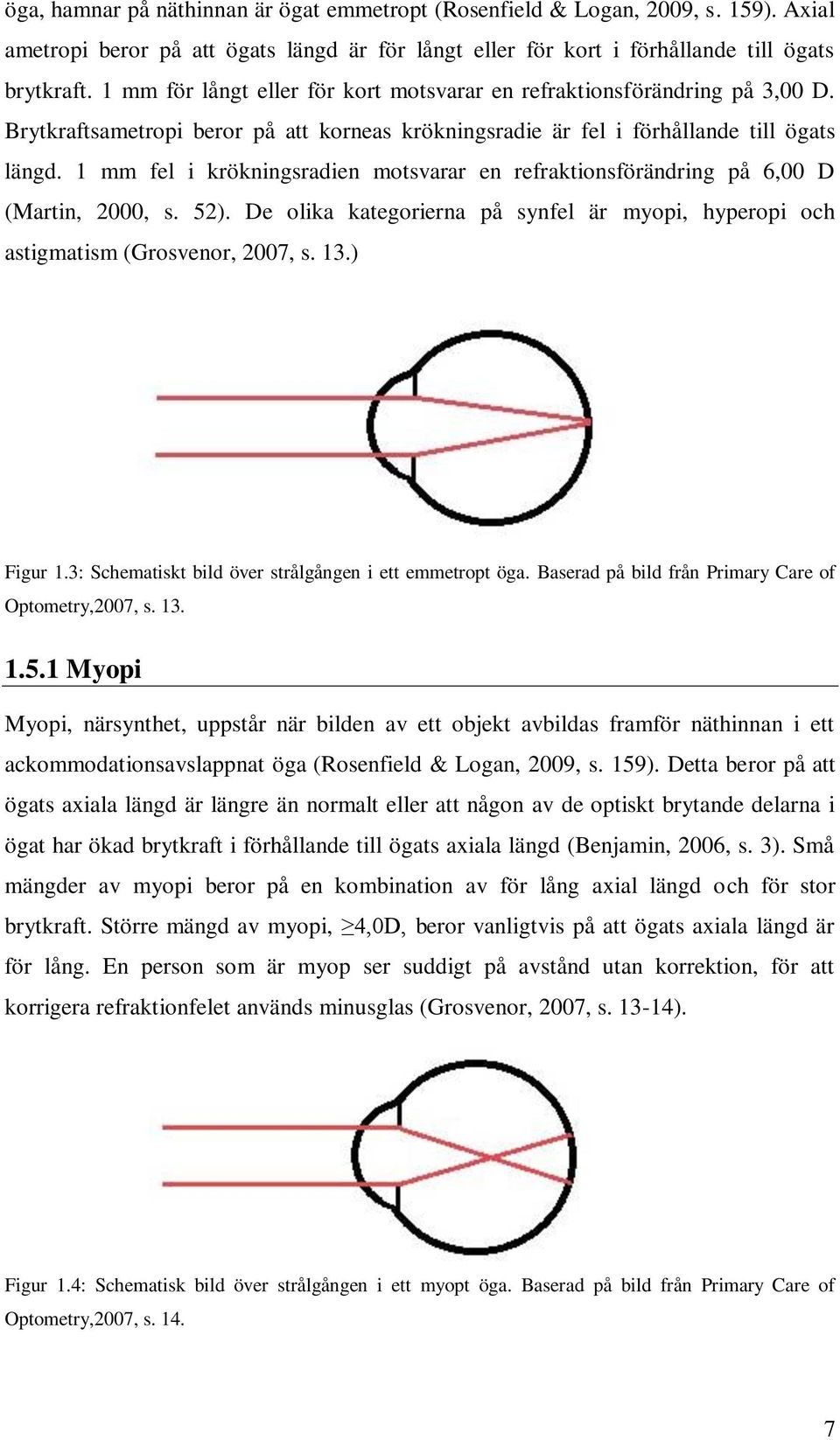 1 mm fel i krökningsradien motsvarar en refraktionsförändring på 6,00 D (Martin, 2000, s. 52). De olika kategorierna på synfel är myopi, hyperopi och astigmatism (Grosvenor, 2007, s. 13.) Figur 1.