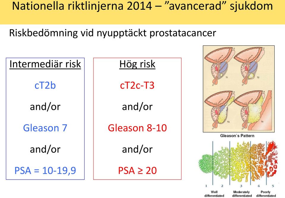 Intermediär risk ct2b and/or Gleason 7 and/or PSA