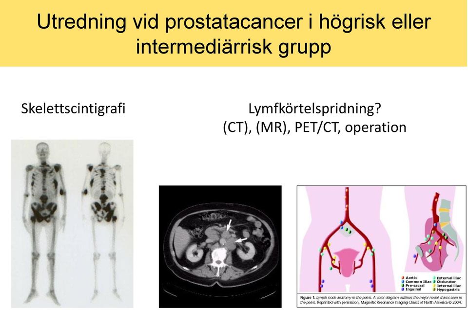 grupp Skelettscintigrafi